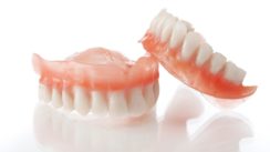Tout savoir sur la prothèse dentaire inlay/onlay céramique Tout savoir sur la prothèse dentaire inlay/onlay céramique